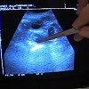 Négylábú kismamák ultrahangon