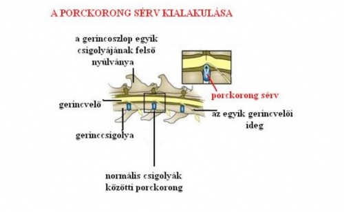 porckorongserv-kialakulasa