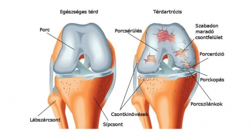 terd1