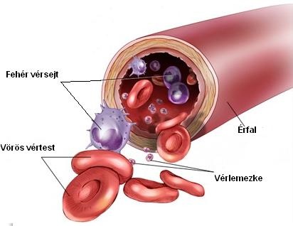 verosszetetel